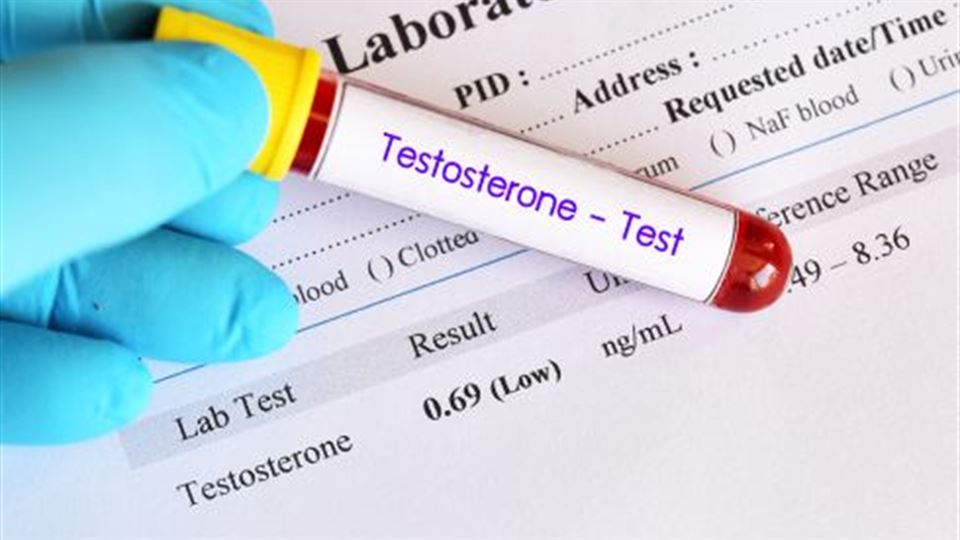 Low Testosterone and Sleep Deprivation Linked to Psoriasis Risk in Men