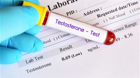 Low Testosterone and Sleep Deprivation Linked to Psoriasis Risk in Men